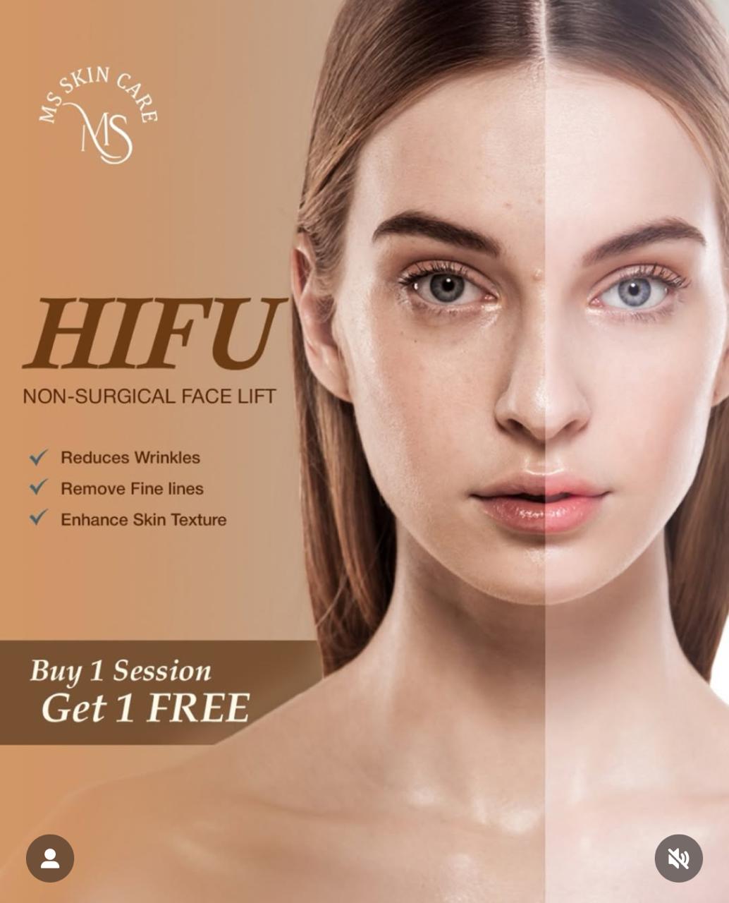 HIFU Treatment