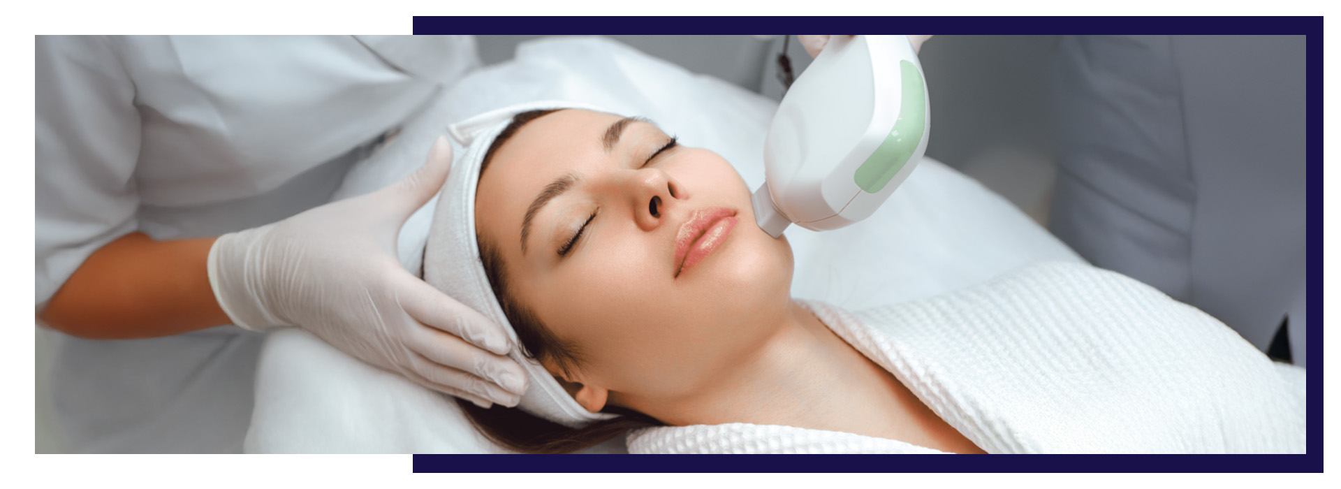 MNRF Treatment