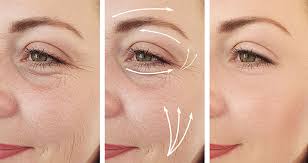 Undereye Threads
