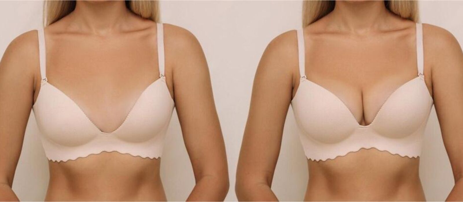Non-surgical breast upliftment Delhi