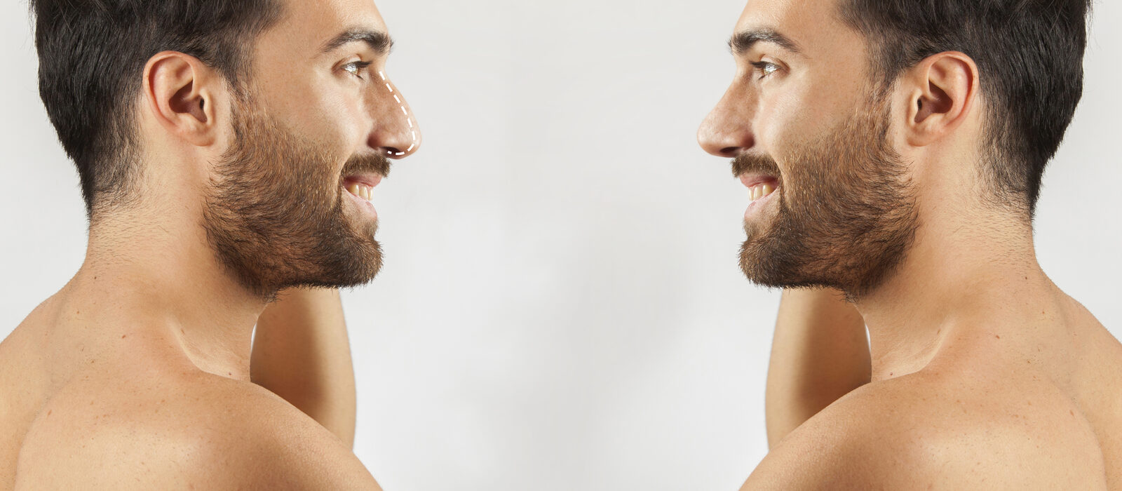 Anti-ageing treatments for men in Delhi