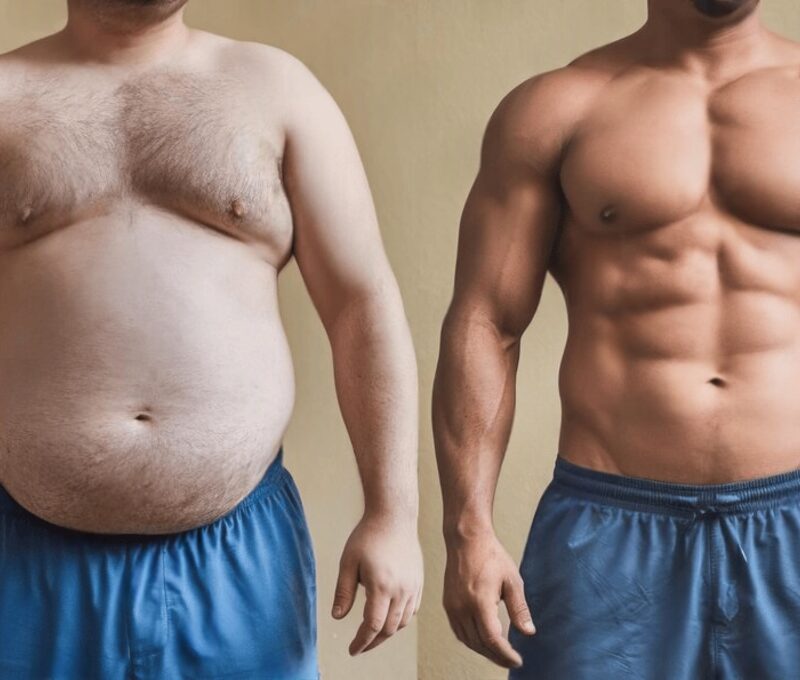 Liposuction for men Delhi